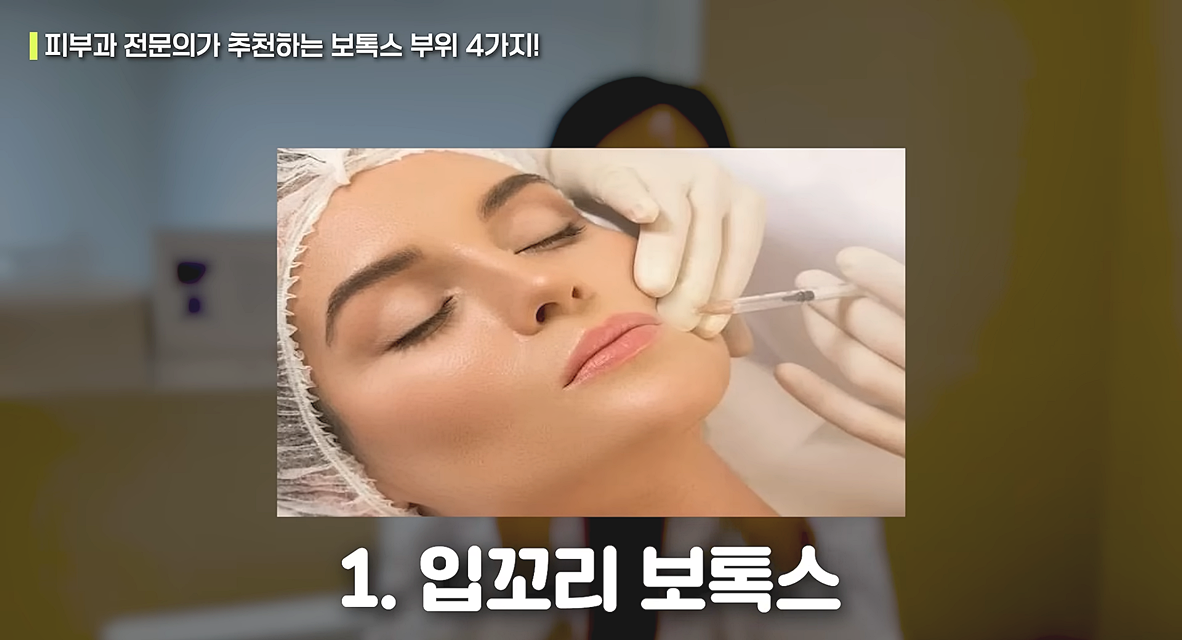 입꼬리 보톡스