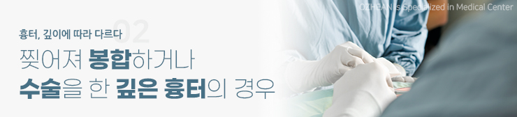 수술 후 봉합 흉터 최소화를 위한 피부과 전문의 맞춤 치료