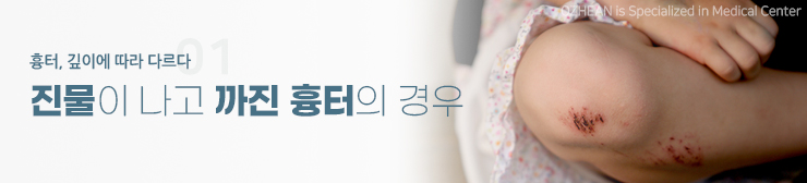 진물이 나는 얕은 상처의 피부과 조기 레이저 치료 원리