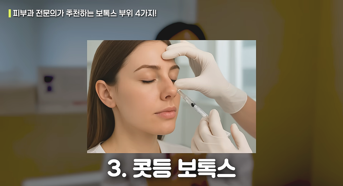 콧등 보톡스