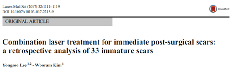 흉터 레이저 조기 치료의 유효성에 관한 2017년 학술 논문 결과