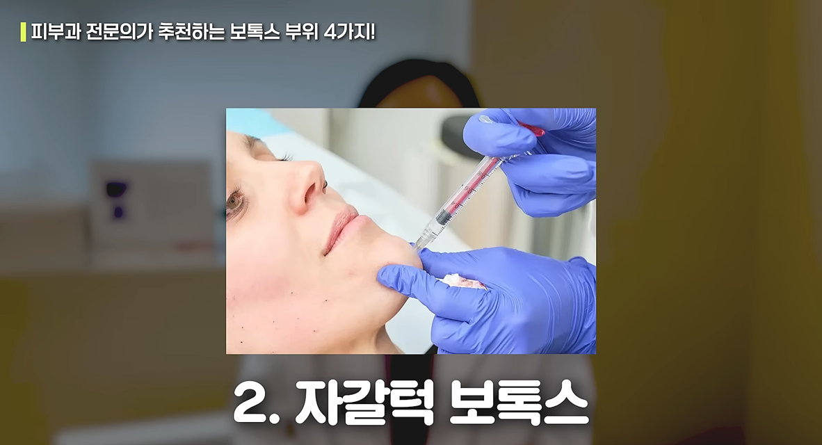 자갈턱 보톡스