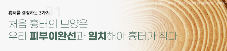 피부이완선과 상처 방향의 관계 설명