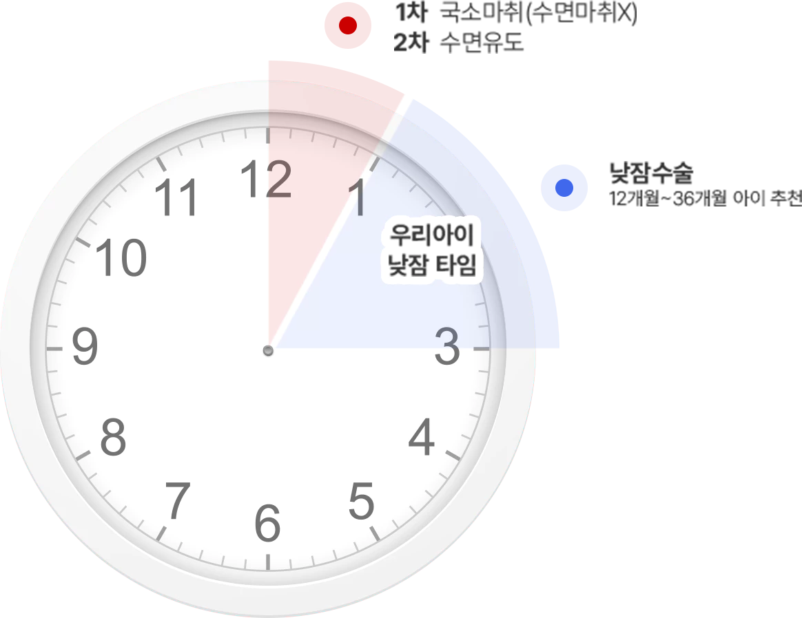 전신마취 없이 국소마취 타임라인 이미지