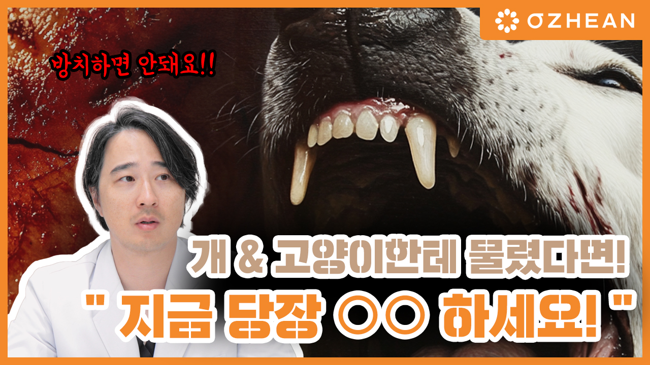 개 & 고양이한테 물렸을 때, 이 3가지만 기억하고 실천하세요! 오체안 뉴스 썸네일